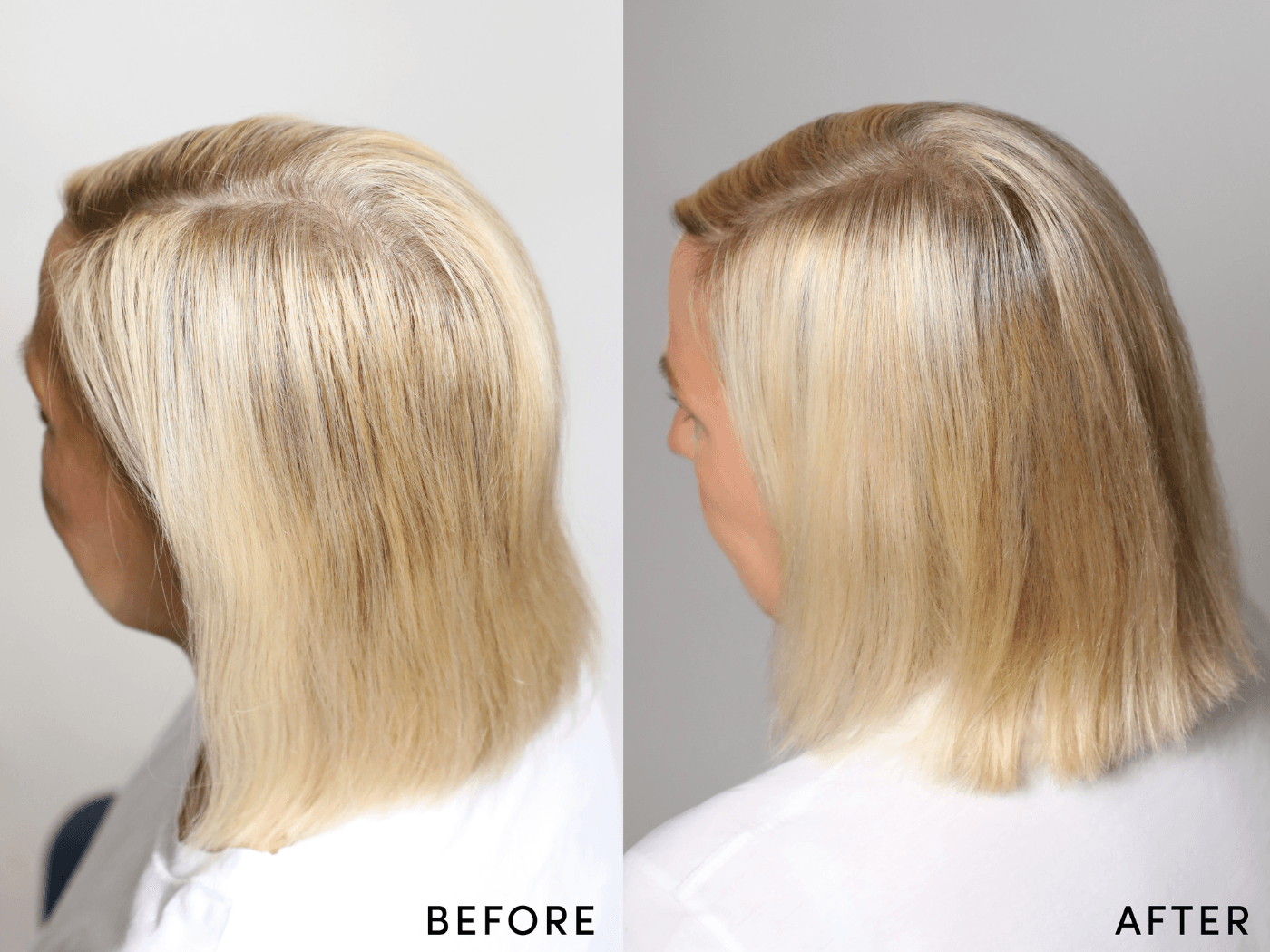 Vorher/Nachher-Bilder von einer Frau nach regelmässiger Anwendung des Hair Activating Serum von M2Beauté